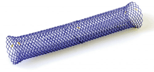 Imagen: El stent esofágico biodegradable BD (Foto cortesía de UK Medical). Imagen: El stent esofágico biodegradable BD (Foto cortesía de UK Medical).